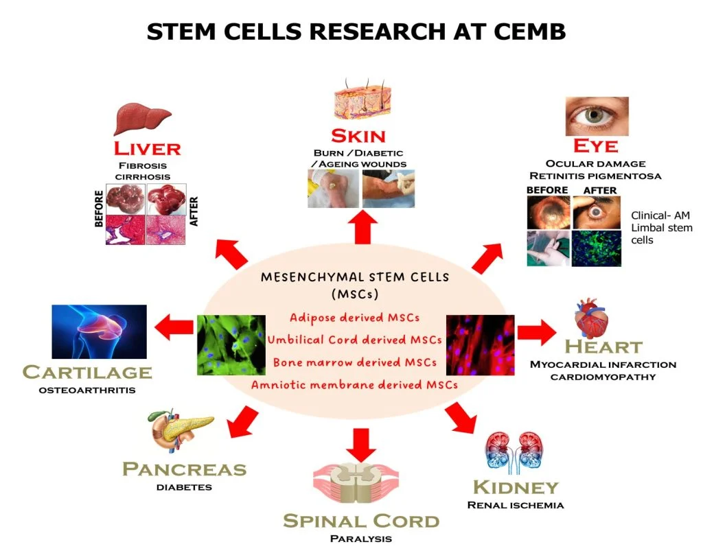 Diagram summarising the stem cell sources and disease conditions addressed by the Stem Cell Research Lab